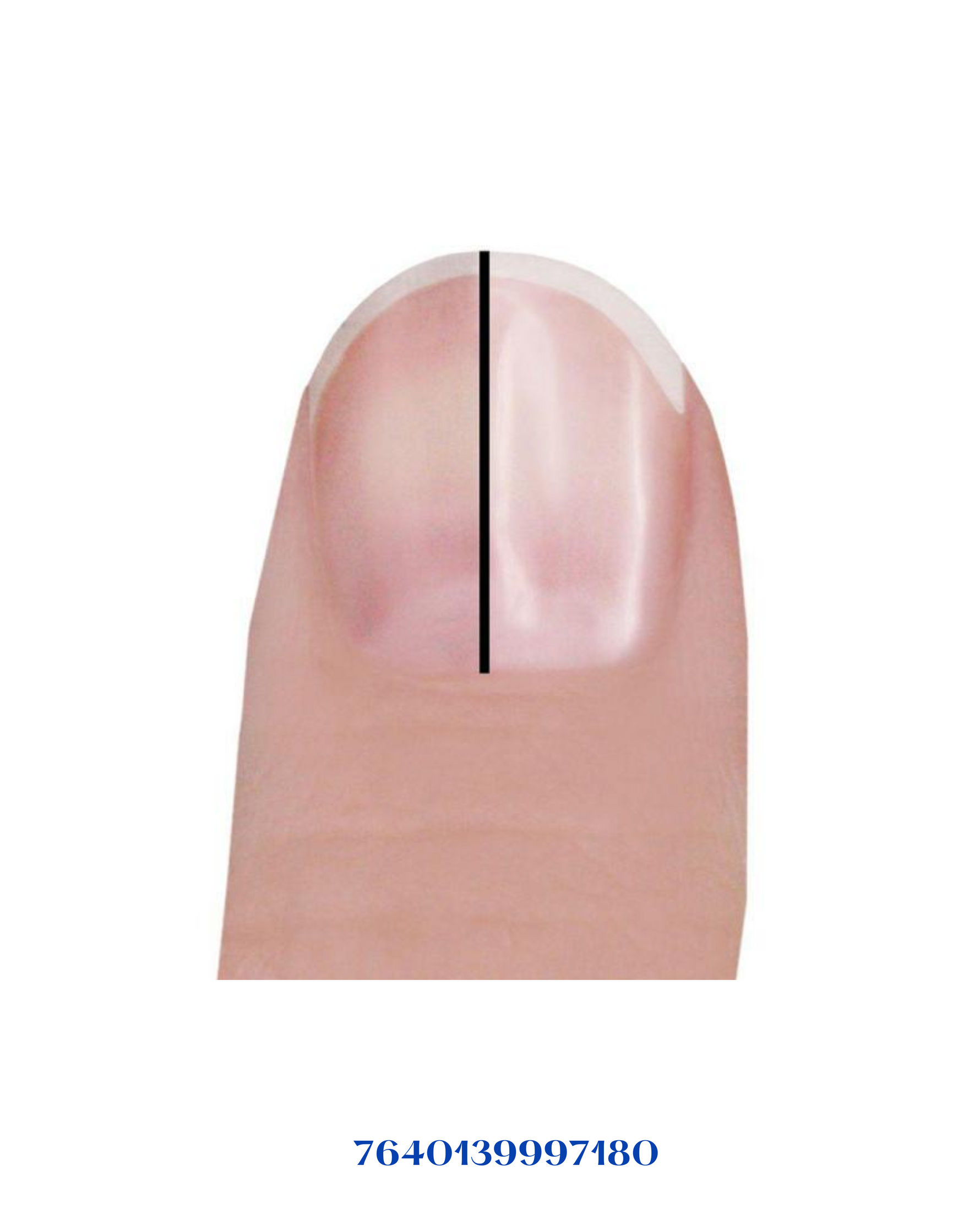 TRISA PERFECT NAILS REPLACEMENT ROLLERS